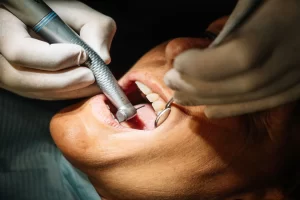 The Top 6 Restorative Dentistry Procedures