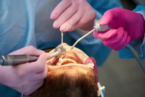 What is Root Canal Treatment?