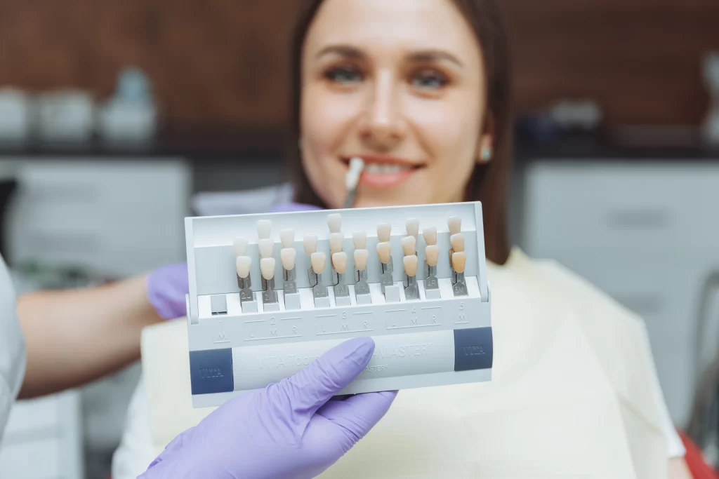 What Are Composite Veneers?