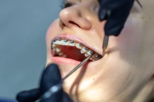 The Difference Between a Dentist vs Orthodontist