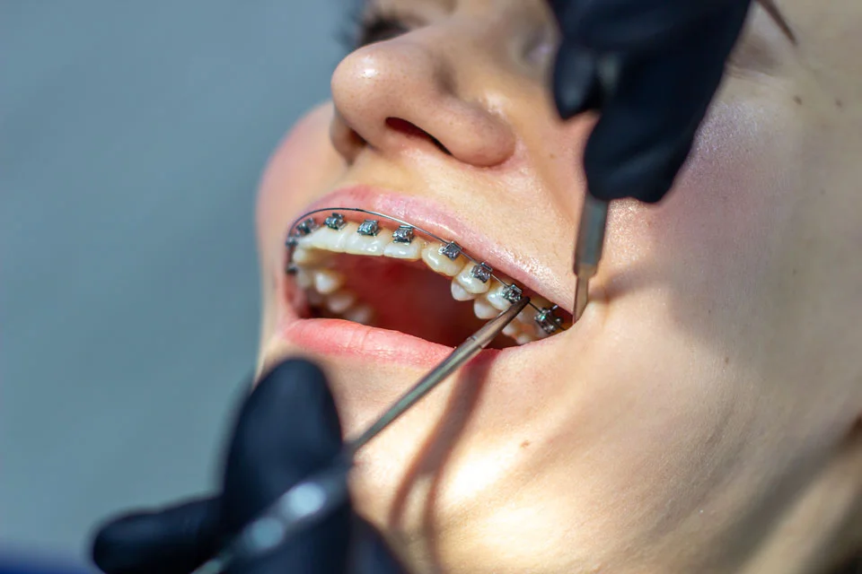 The Difference Between a Dentist vs Orthodontist