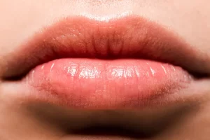 Lip Swelling: What Causes Lips to Swell? 7 Causes Explained