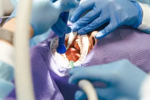 What Is a Dental Bone Graft, and Why Does Your Dentist Recommend It?