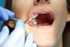 Gum Disease and Dental Implants