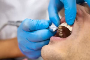 Effective Ways to Treat Tooth Erosion