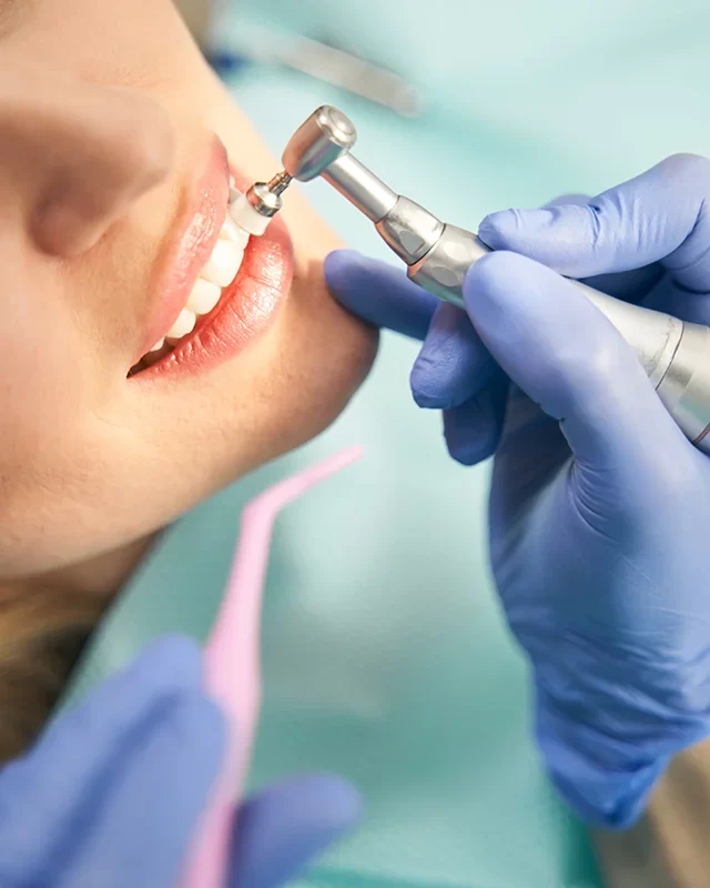 Benefits of Dental Cleaning