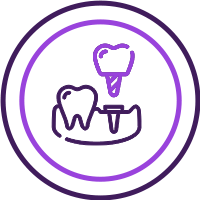 Dental Implants Long Term Durability