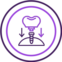 Dental Implants Natural Look Icon