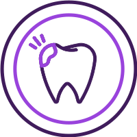 Dental Sealants Prevents Cavities