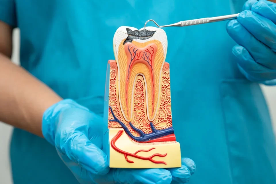 Benefits of Root Canal Treatment
