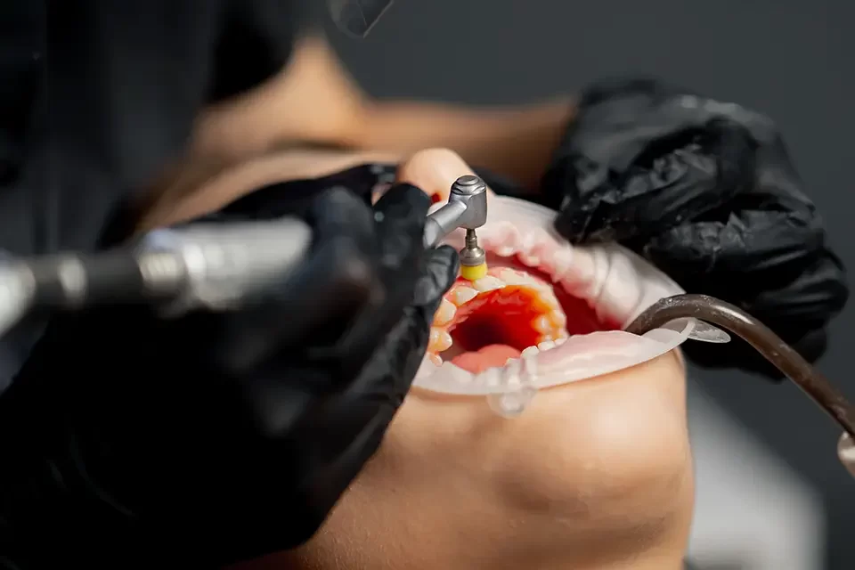 dental treatment process Why Might Your Dentist Recommend a Dental Bone Graft?