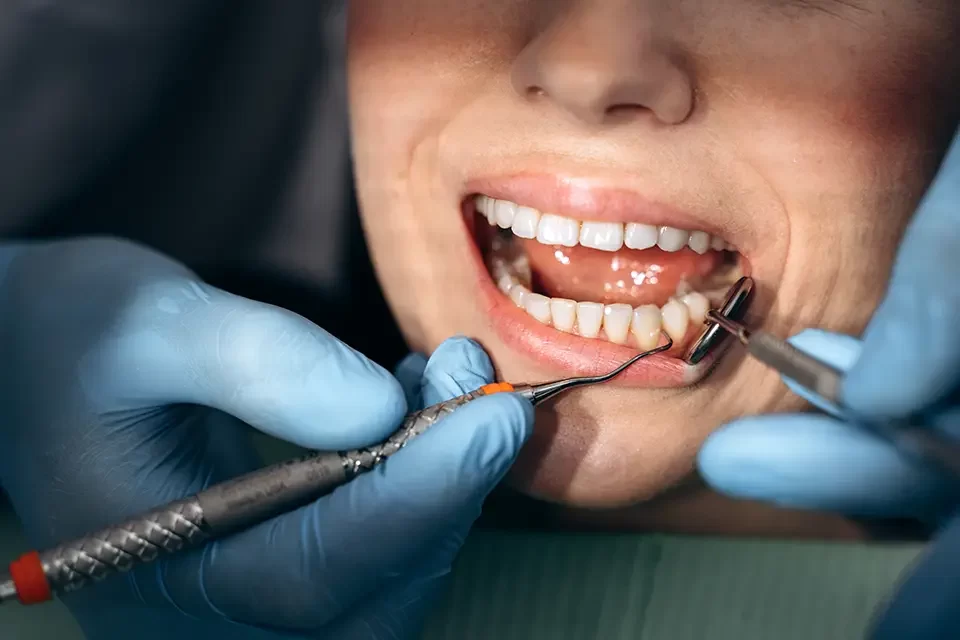 dental treatment Causes of Cracked Teeth