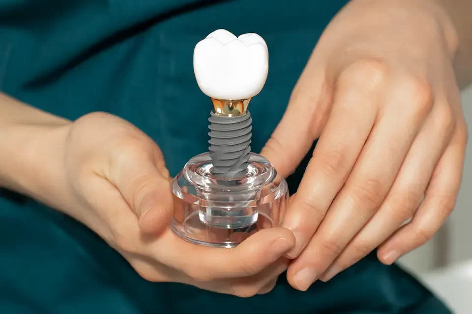 Dental Plates vs Implants: Durability and Bone Health