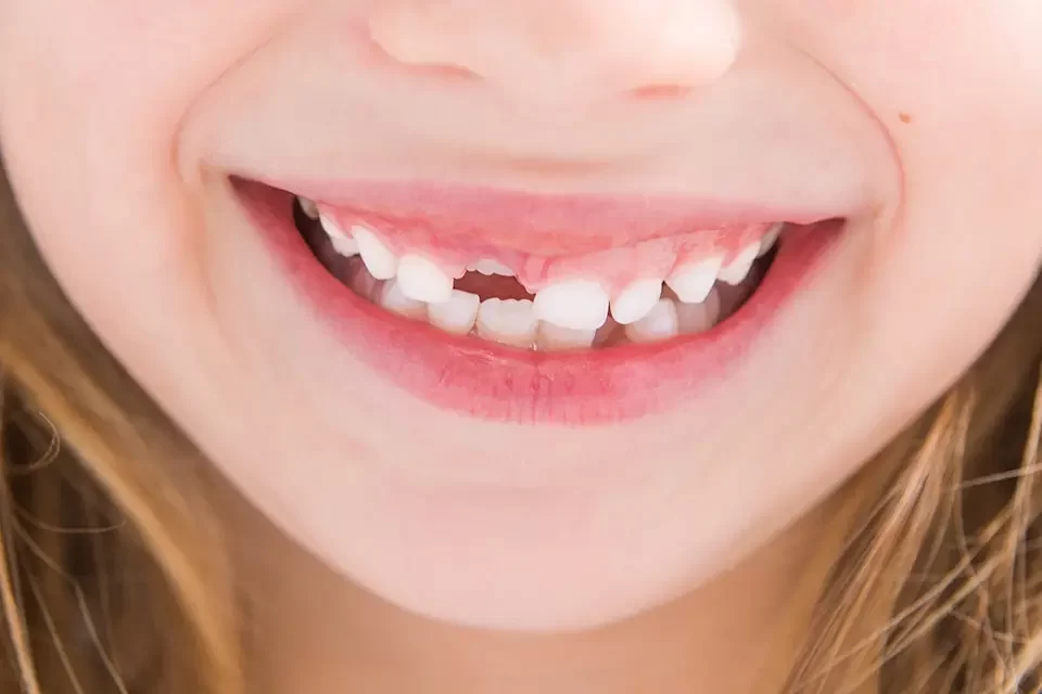 Dental Crowns for Kids in Richmond Hill