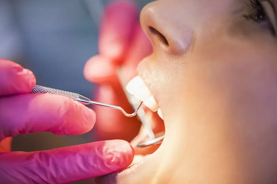 What Is Fluoride Treatment for Children's Teeth?