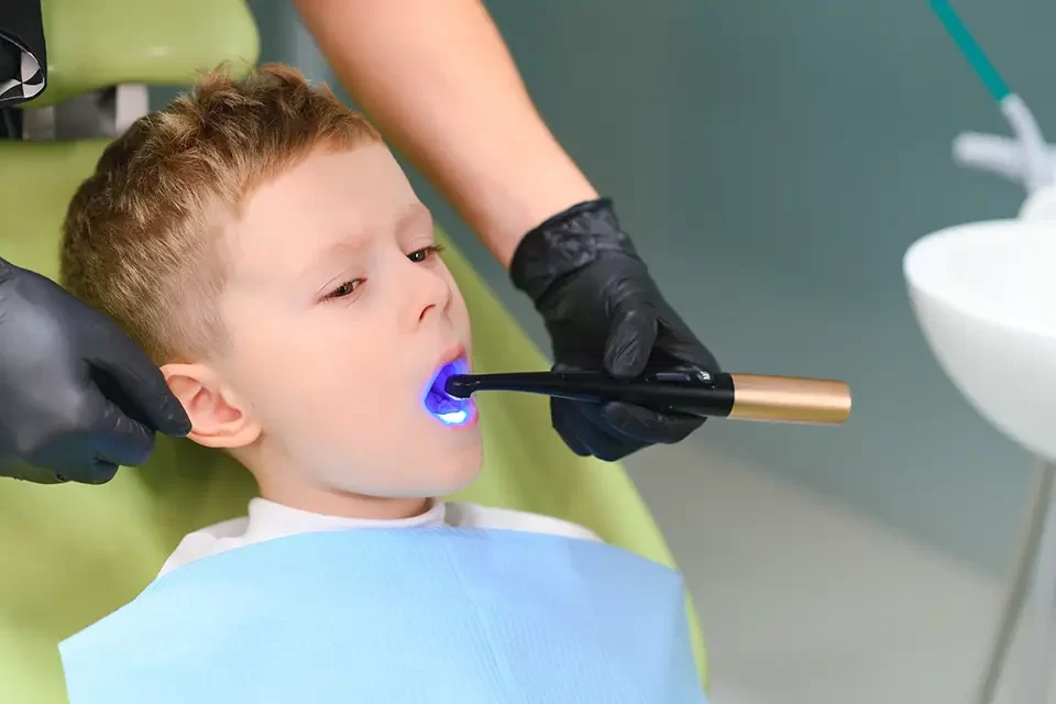 Different Types of Fluoride Treatment
