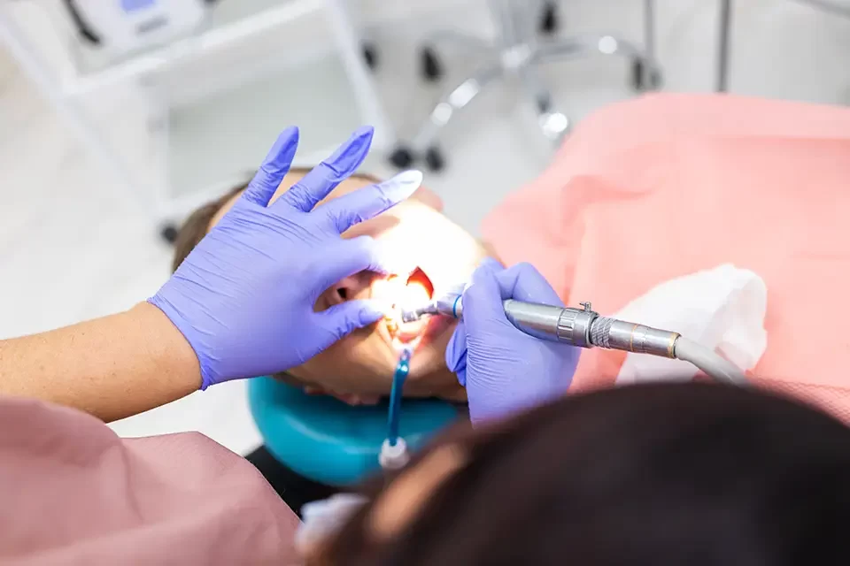 What Causes Dental Fillings to Fail?: Estimated Cost, Insurance, and Sensible Timing