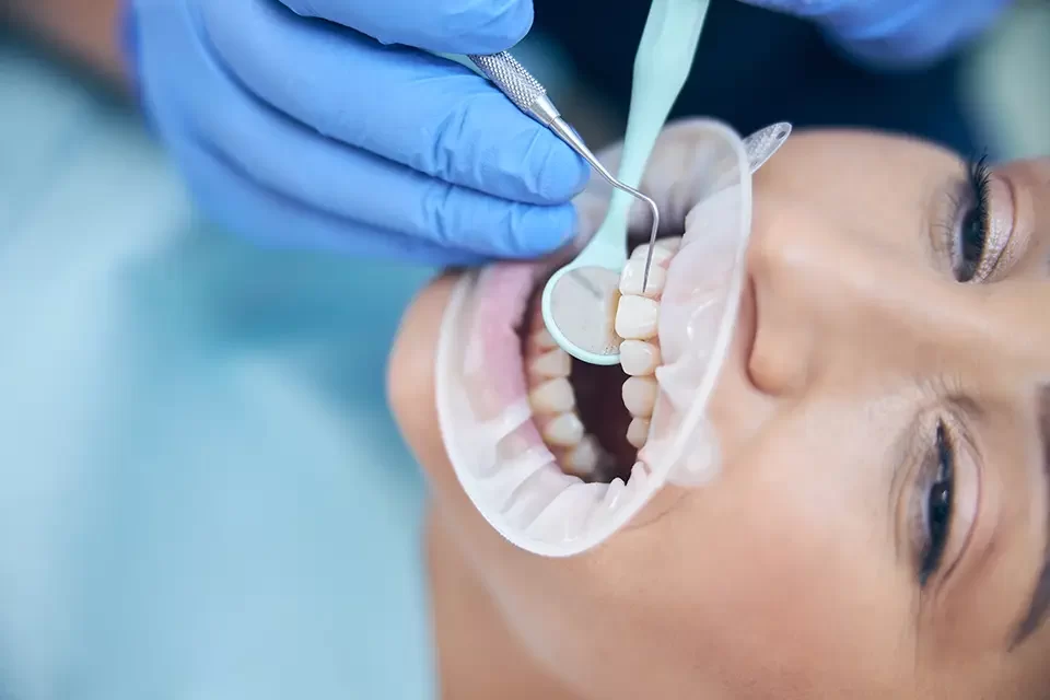 Gum Recession: The "Everyday" Exposed Tooth Root Sensation
